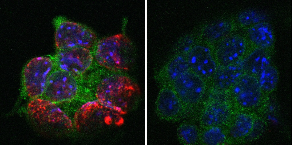 Mouse embryonic stem cells (blue, green) lose DNA methylation (red) in the absence of UHRF1